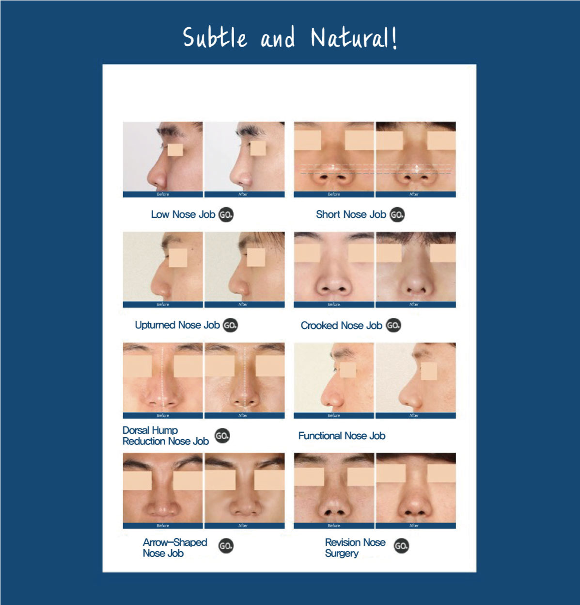 Men's eye and nose surgery