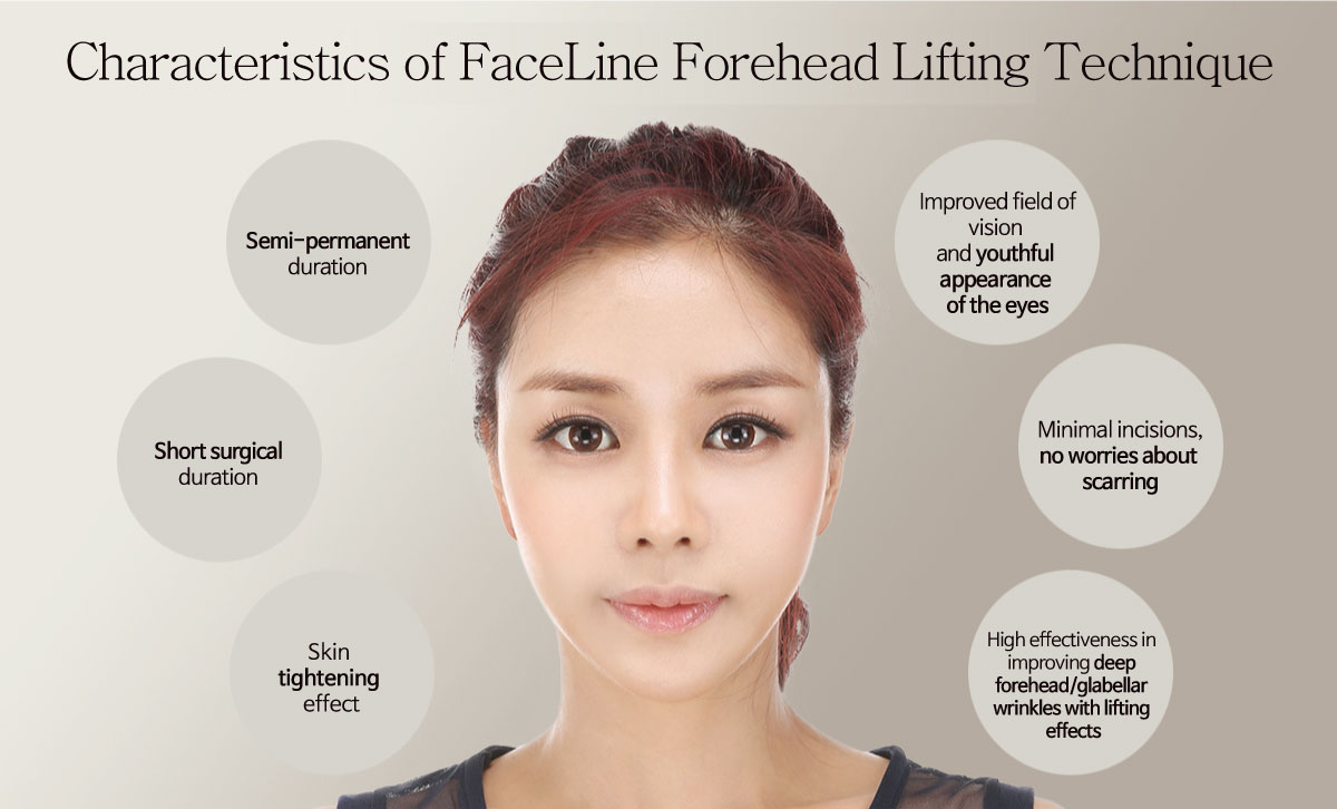 Forehead Lifting