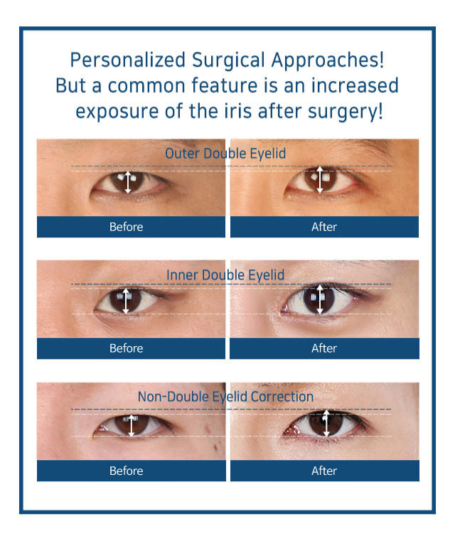 Men's eye and nose surgery
