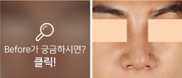 Men's eye and nose surgery