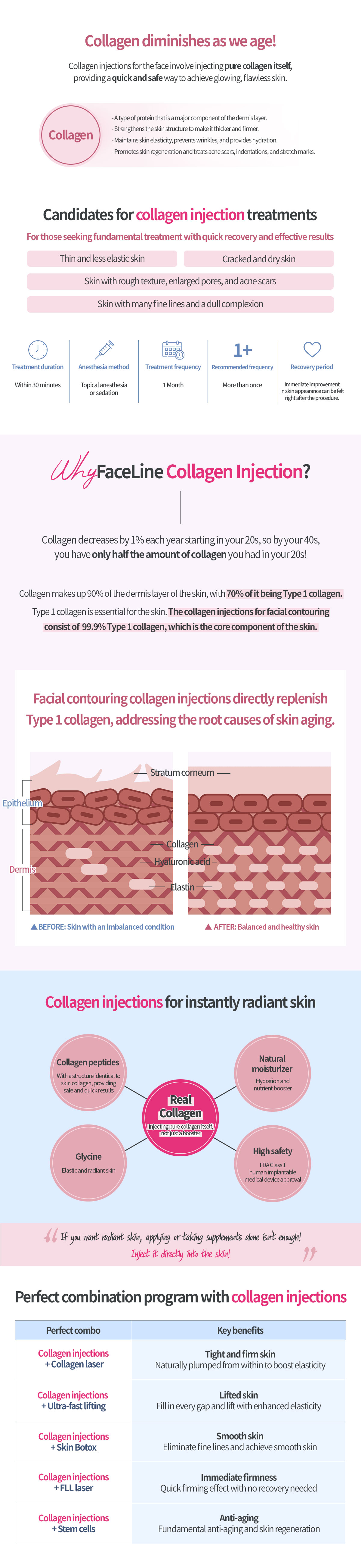 Collagen Injection